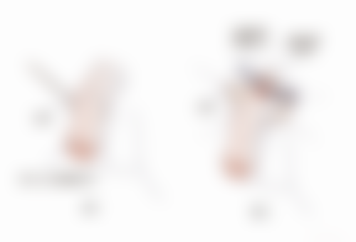 刘国强医生项目优势