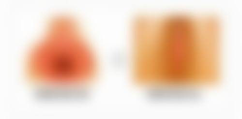 50岁做双眼皮全切的修复时间分析