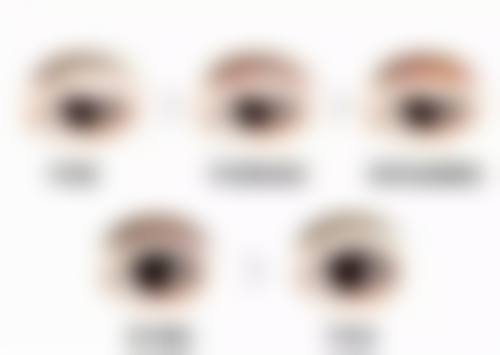 自体软骨隆鼻:安心至上,隆鼻手术材料中的放心之选