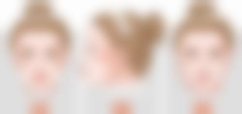 隆鼻手术材料都有哪些？硅胶、膨体、自体软骨、玻尿酸全解析