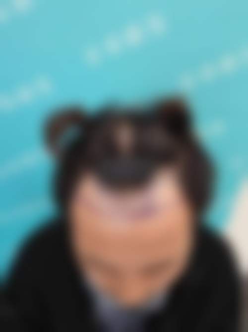 卜忠兴医生怎么挂号