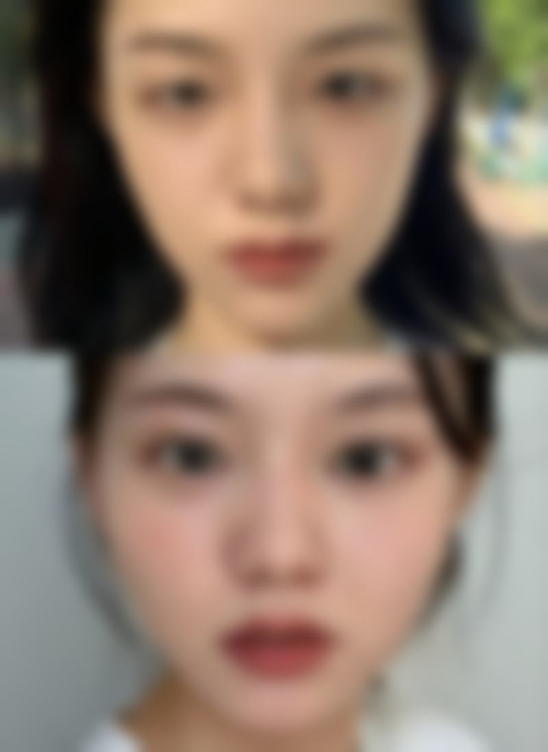 青岛惟一整形医院项目特色