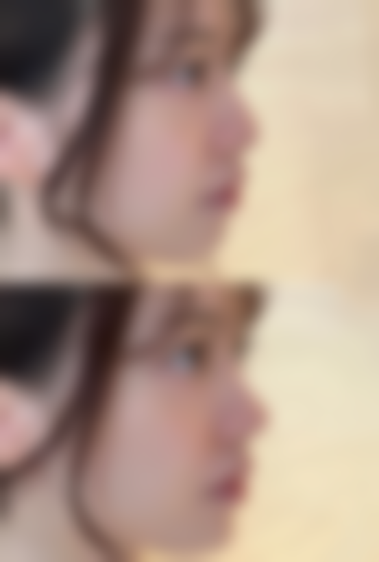 怎么去除黑的疤痕之日常护理：巩固“扫黑”成果