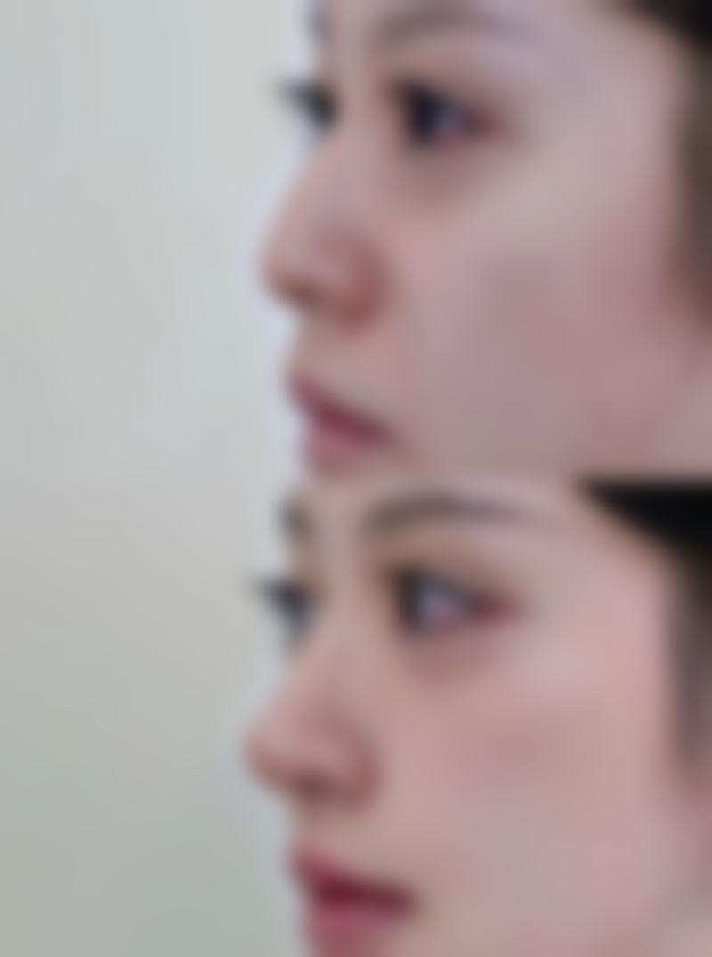 刘国强医生顾客实例图片