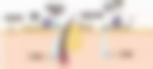 七、延长“保质期”的10个实用小贴士——假体隆胸的成效能保持多久与日常保养