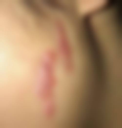 延安颜术整形医院怎么样之口碑好不好？附真实患者口碑评价