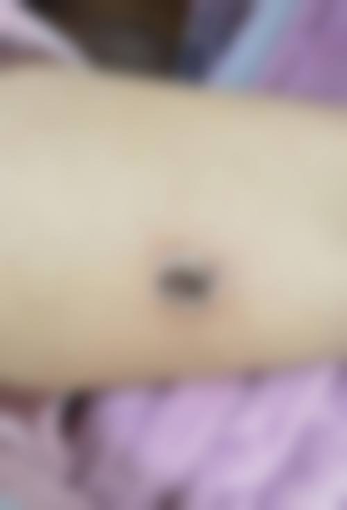 韩国VANNY整形医院怎么样，口碑评价如何？