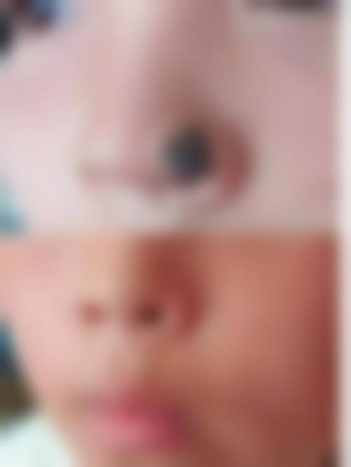 郑州奕美整形医疗美容门诊部怎么样