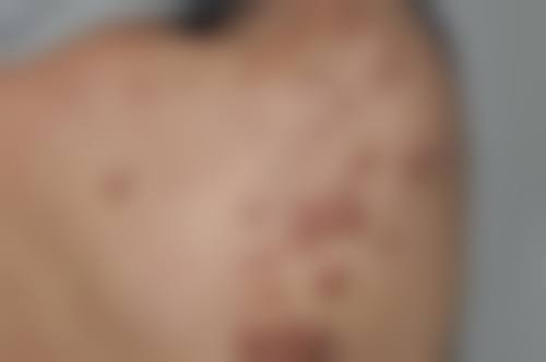 韩国VANNY整形医院怎么样价格表