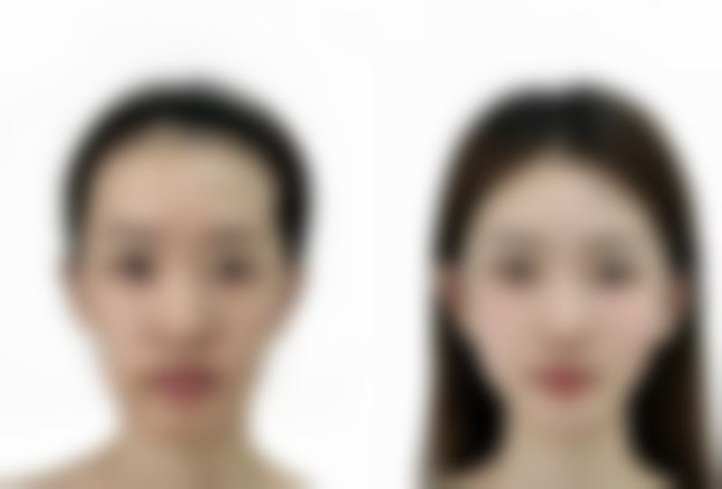 许柯医生简介项目优势