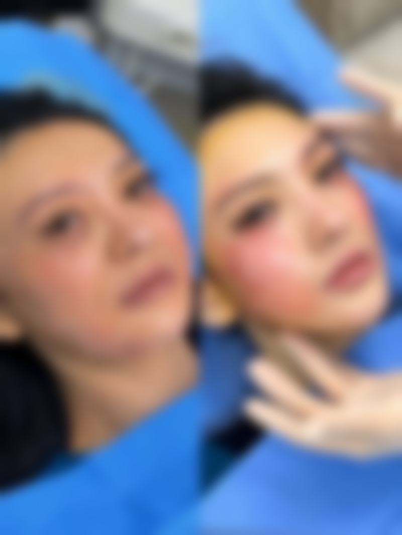 北京伊思凯丽医疗美容抖音团购活动及价格表