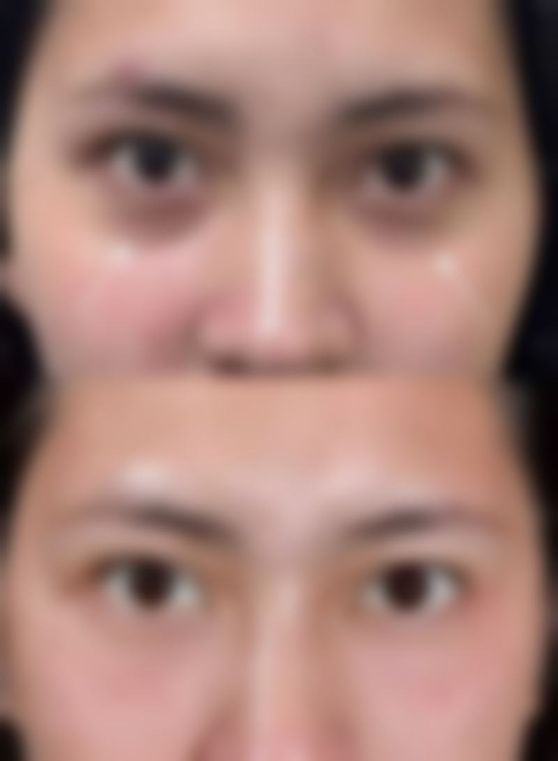 绵阳蜜拉心颜整形医院怎么样之口碑好不好?附真实患者口碑评价