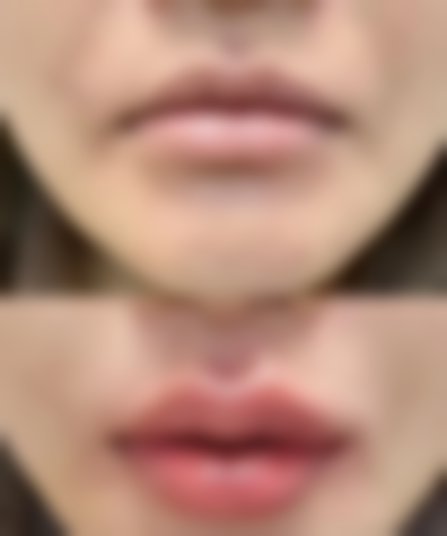 姚丽霞医生简介项目优势