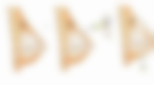 尾段：告别眼袋，重拾自信