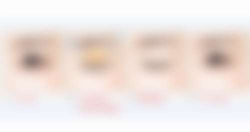 北京协和医院论埋线双眼皮的修复优势