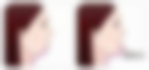 抓伤的伤疤痕迹怎么消除：医院指导初期黄金护理法则