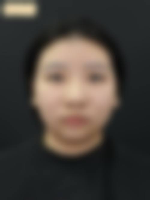 八、韩国卓凯整形医院怎么样价格表