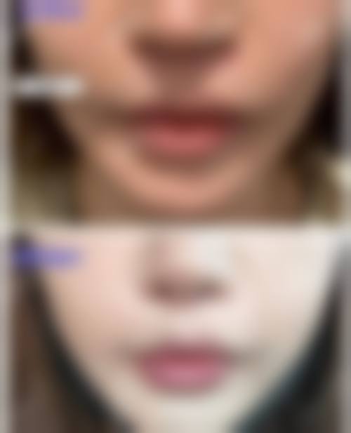 贵阳奥拉克医疗美容诊所怎么样,更擅长什么手术