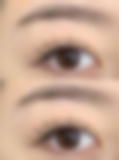 成都艺美汇植发门诊部顾客实例