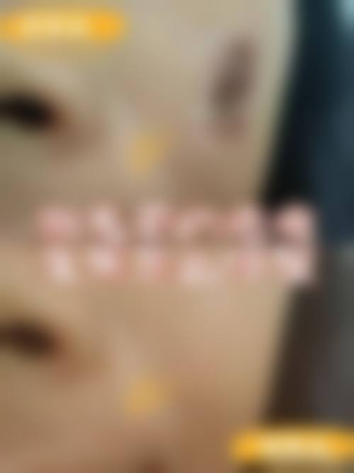 毕星星医生口碑如何