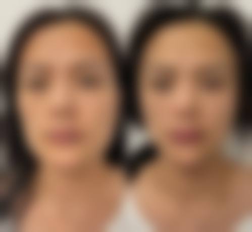 长沙祺美医疗美容门诊部顾客实例