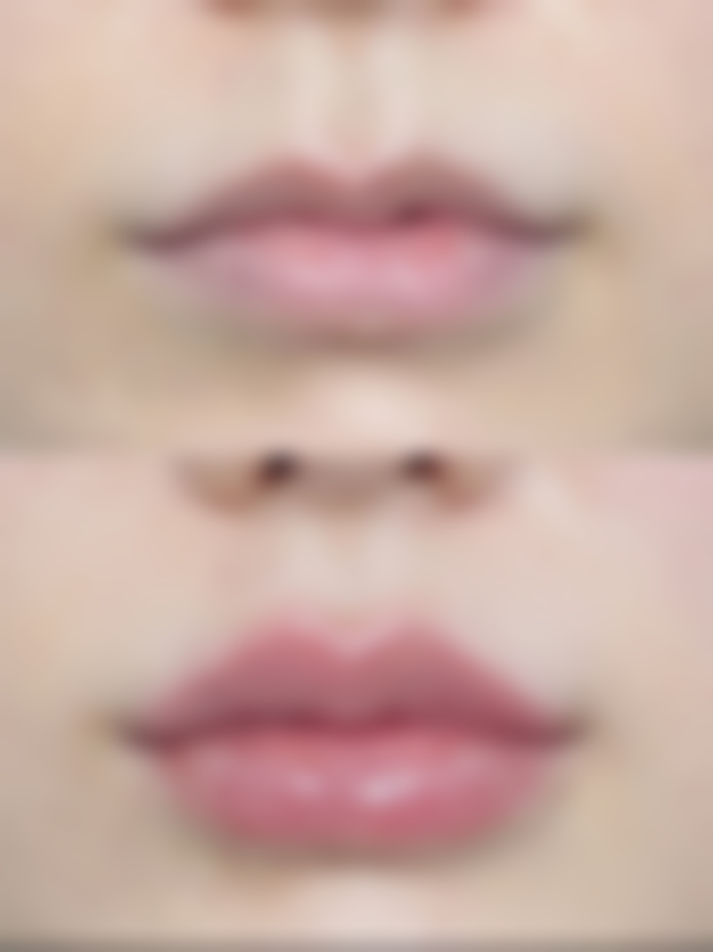 杜军 医生简介项目优势