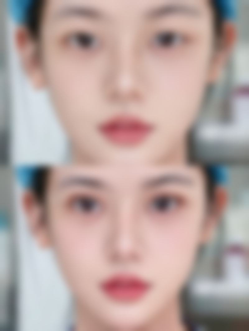 毛艳红医生简介做手术价格