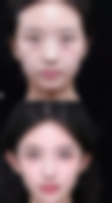 三、韩国卓凯整形医院怎么样怎么样,口碑评价如何?