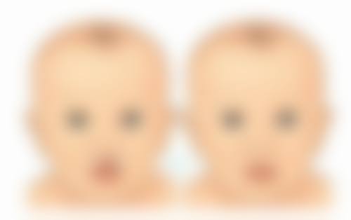 疤痕体质的外伤疤痕自己会消除吗——日常意外中疤痕体质的烦恼