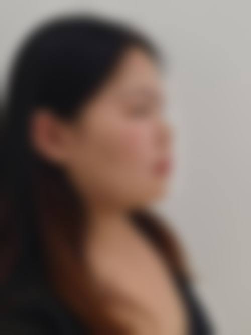 承德凯丽医疗美容门诊部顾客实例