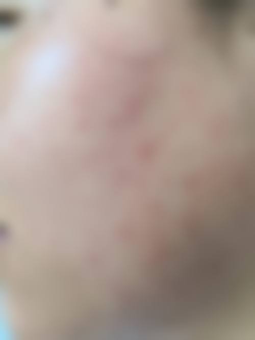 承德市中 心医院皮肤科真实患者口碑评价