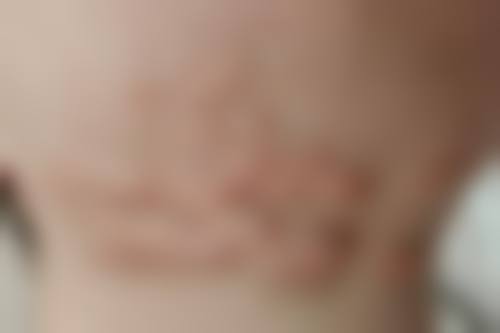 无锡中医医院整形美容科地址及乘车路线