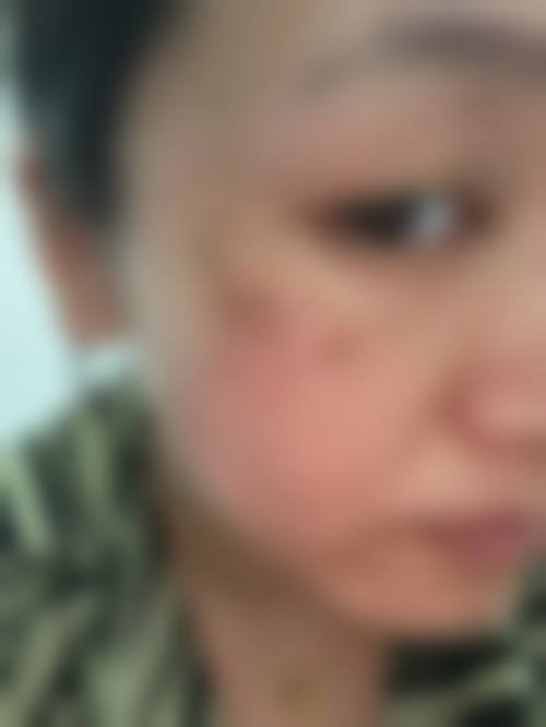 湖北汀恩医疗美容怎么样，抖音团购活动及价格表