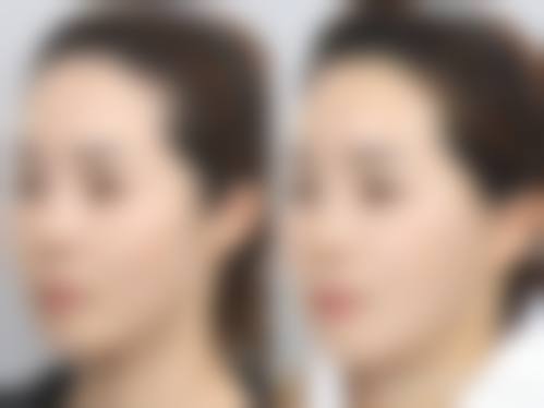 承德凯丽医疗美容门诊部怎么样