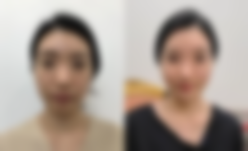 岳阳乔微雅整形医院怎么样,口碑评价如何?