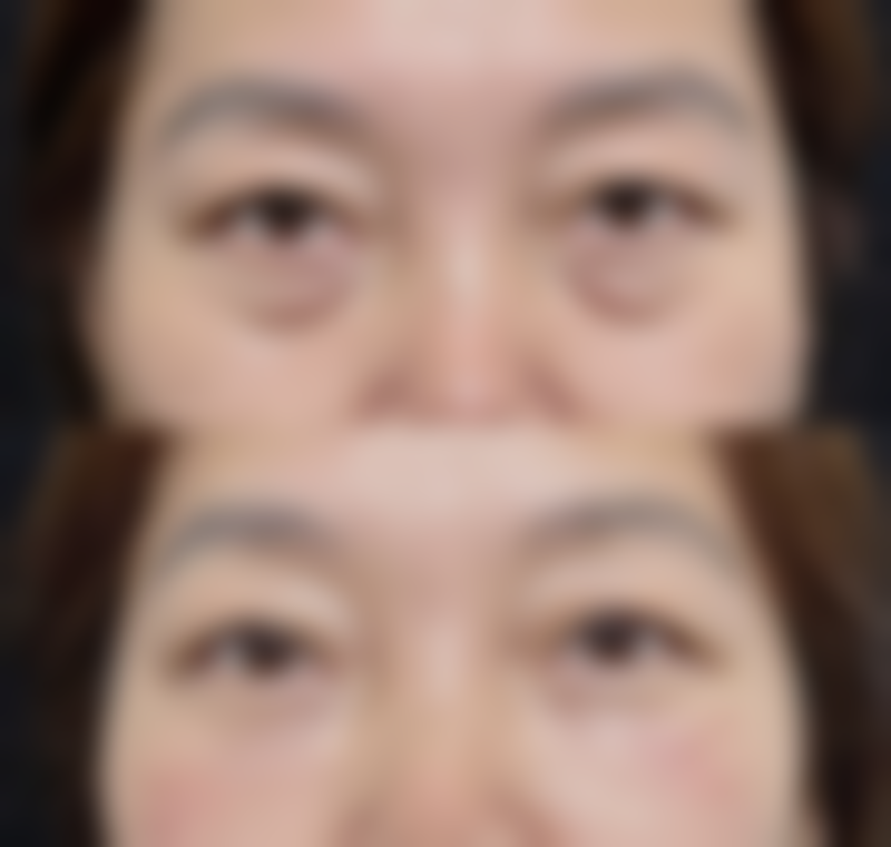 疤痕体质的科学应对策略