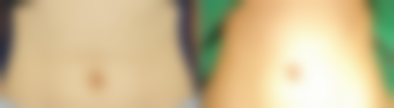 吴海霞医生做手术价格