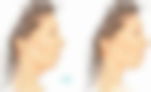 刘亚莉医生项目优势