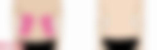 刘亚莉医生口碑如何