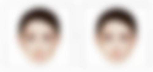 眼皮厚适合哪种双眼皮：平行型双眼皮——厚眼皮的“显瘦神器”