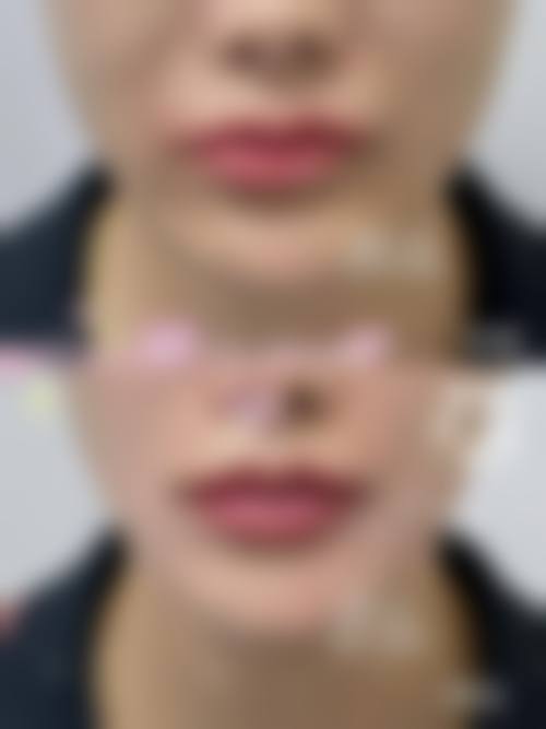 重庆佳兰博美汇医疗美容诊所更擅长什么手术