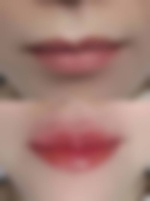 重庆佳兰博美汇医疗美容诊所更擅长什么