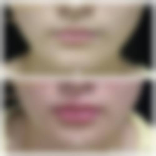 北京点度医美上班时间和地址在哪儿?怎么样