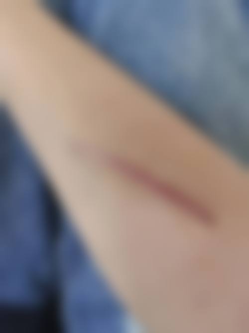 钟丘医生项目优势