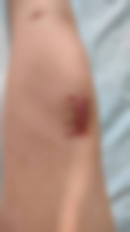 廊坊咏颜医疗美容诊所价格表