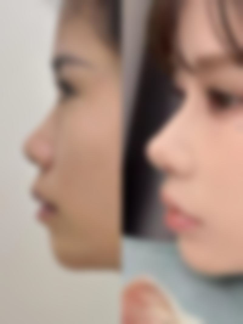 邢台美在人生医疗美容诊所可靠吗