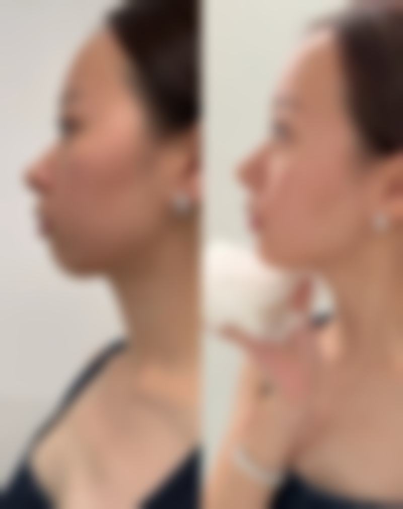 中山九九医疗美容门诊部怎么样，特色项目有哪些