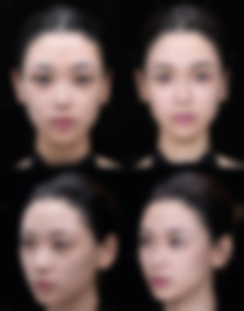 眼部按摩仪可以去黑眼圈眼袋吗——热敷+按摩双效原理深度揭秘