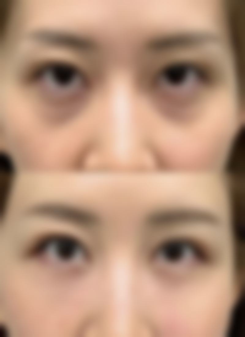 国内医学科学 院整形外科医院推荐：3种科学修复方案