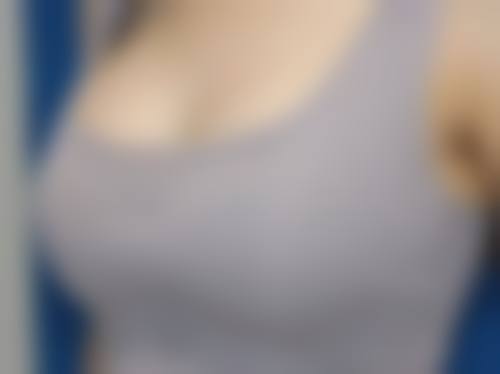 玻尿酸隆鼻子能保持一辈子吗？便捷与时效并存的临时美鼻之选